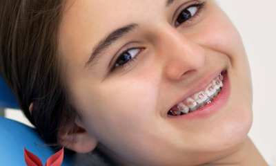 Cosmetic-dentist-mission-viejo-speaks-about-the-advantages-of-lingual-braces