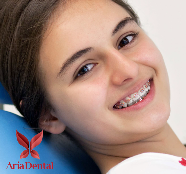 Cosmetic-dentist-mission-viejo-speaks-about-the-advantages-of-lingual-braces